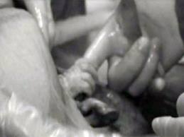 babyreachingforhandfromwomb2