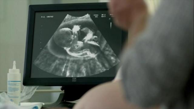 doritos-super-bowl-2016-ultrasound-large-5