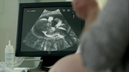 doritos-super-bowl-2016-ultrasound-large-5